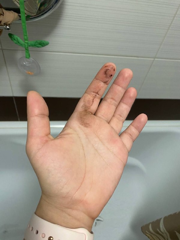 *